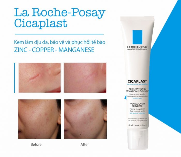 Kem trị sẹo thâm La Roche Posay Cicaplast Pro-Recovery Skincare
