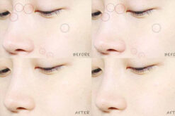 cosrx-acne-pimple-master-patch-22