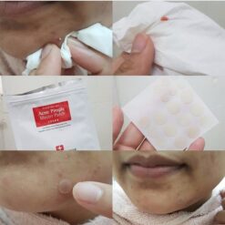 cosrx-acne-pimple-master-patch-8
