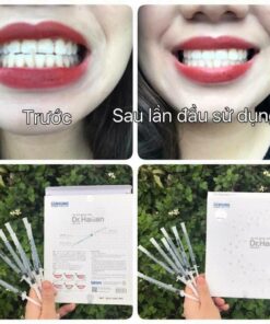 gel-lam-trang-rang-dr-haiian-proessional-clinic-10