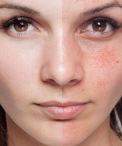 kem-duong-da-chong-lao-hoa-collagen-21