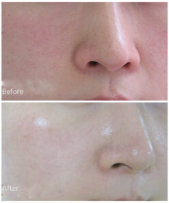 serum-chong-lao-hoa-timeless-pure-natural-serum-8