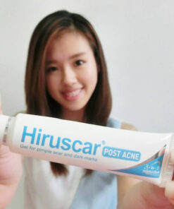 kem tri seo hiruscar post acne 6
