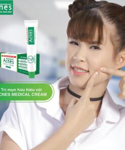 sua rua mat tri mun acnes 8
