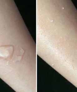 tay da chet botanical natural peeling gel 3 700x525