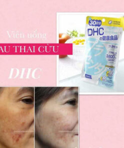 vien uong nhau thai dhc placenta nhat ban 60 vien 20 ngay 4