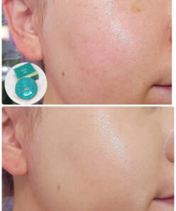 phan nuoc blandoux che khuyet diem 5