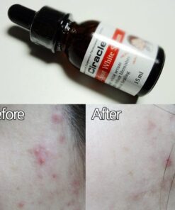 tinh chat tri tham ciracle red spot white serum 2