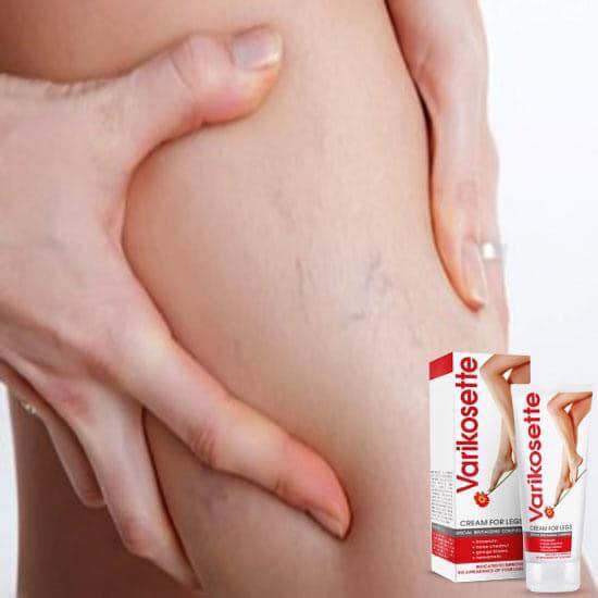 Kem Varikosette Cream For Legs Special Revitalizing Complex