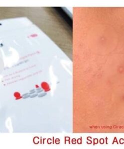 ciracle red spot acne pimple patch 4