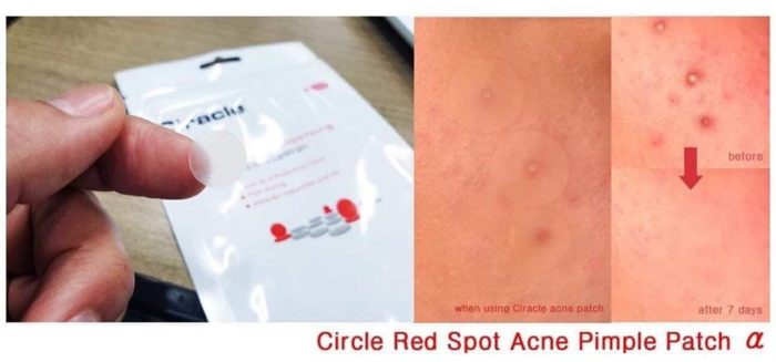 Miếng dán mụn Ciracle red spot acne pimple patch