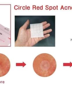 ciracle red spot acne pimple patch 5