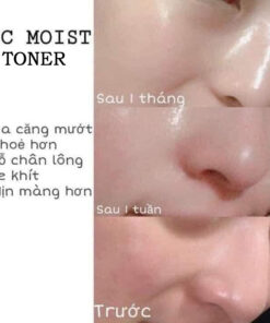 nuoc can bang white collagen total remedy toner 8