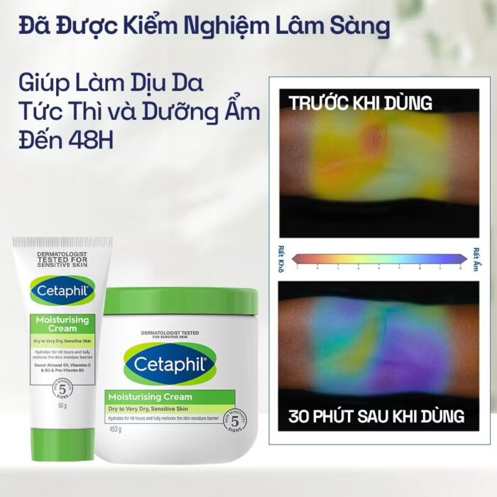 Kem dưỡng ẩm Cetaphil Moisturizing Cream