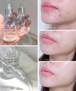serum kiehls1
