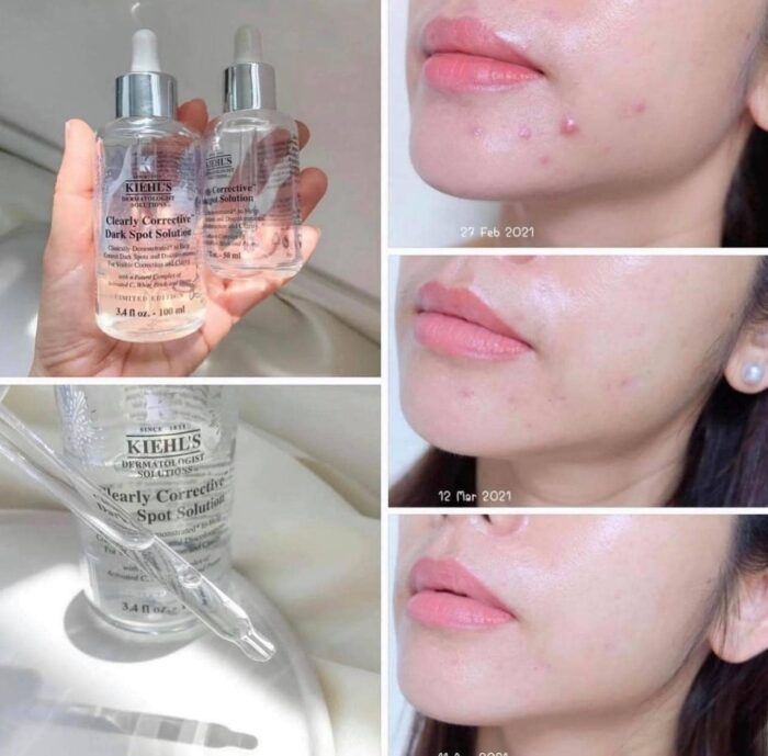 Serum Kiehl's Clearly Corrective Dark Spot Solution