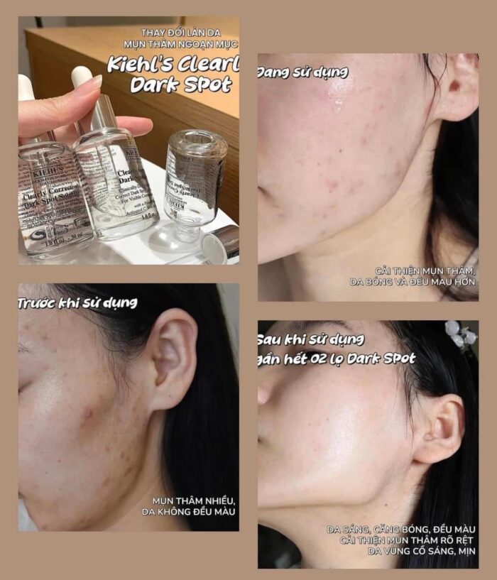 Serum Kiehl's Clearly Corrective Dark Spot Solution