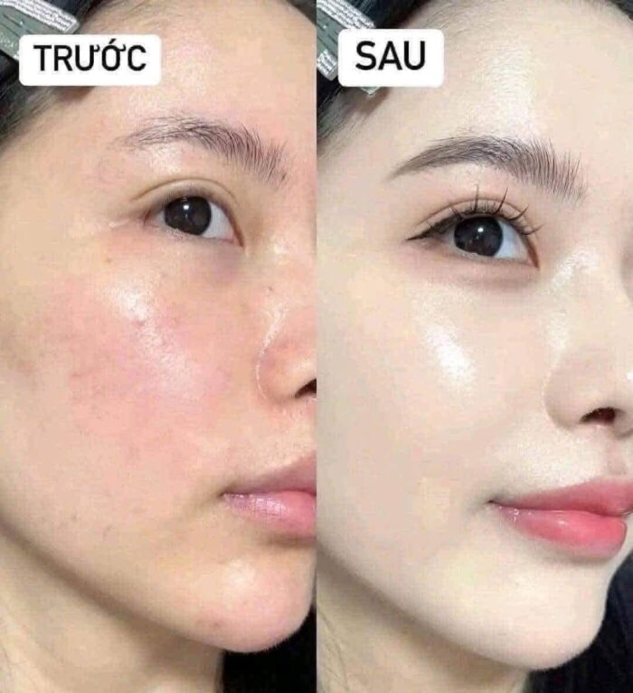 Kem nền Make Up ForEver HD Skin Foundation