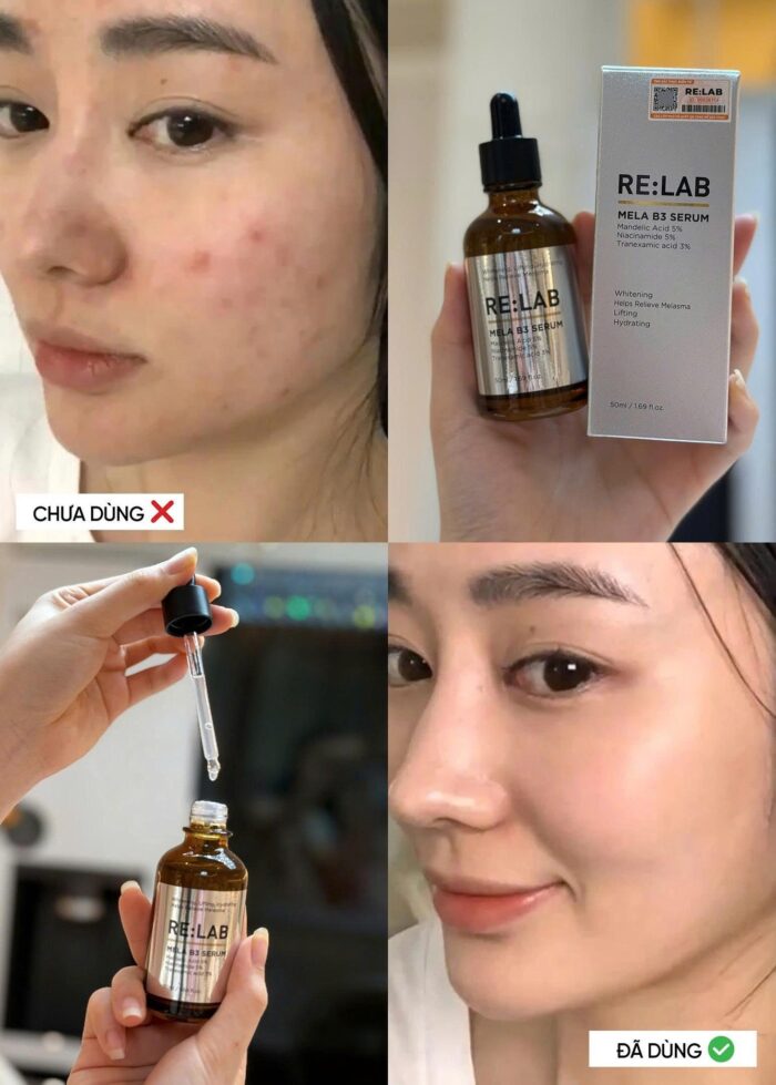 Serum Relab Mela B3 Dưỡng Trắng Mờ Nám Mụn