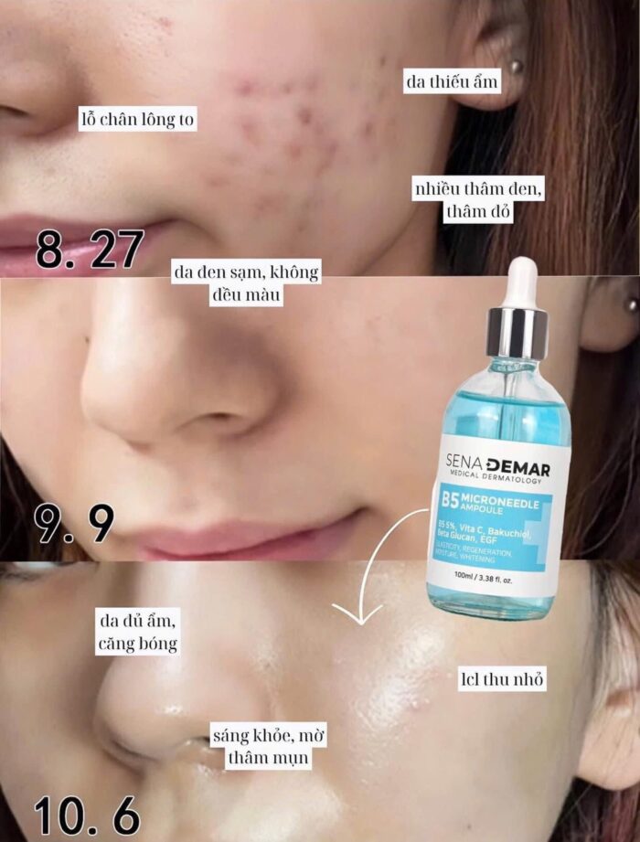 Serum Senademar B5 Microneedle Ampoule