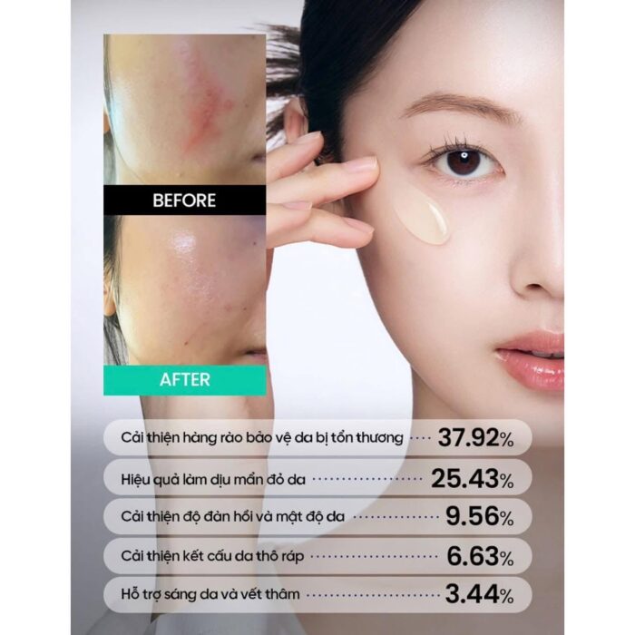 Kem dưỡng Beplain Cica PDRN Repair Cream