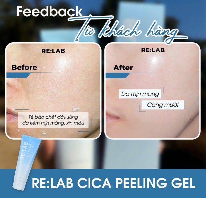 Tẩy Da chết Relab Cica Peeling Gel
